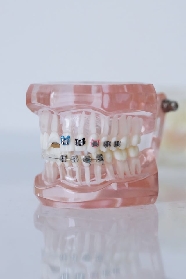 3. From Braces to Bridges: What Every Generation Should Know About Their Teeth